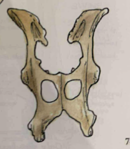 <p>wing of ilium is divided into 2 fossae by distinct gluteal line&nbsp;</p>