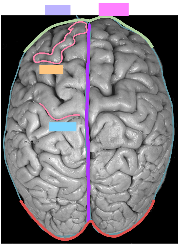 <p>What is the green line in this picture?</p>