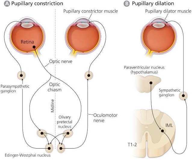 <ol><li><p>From Retina</p></li><li><p>Through Optic nerve</p></li><li><p>Integrated through Olivary Pretectal Nucleus to Edinger-Westphal Nucleus</p></li><li><p>Through Oculomotor nerve</p></li><li><p>Through Parasympathetic Ganglia</p></li><li><p>To Pupillary constrictor muscle</p></li></ol><p></p>