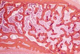 <p>Internal lattice of trabeculae; lighter and houses red or yellow marrow.</p>