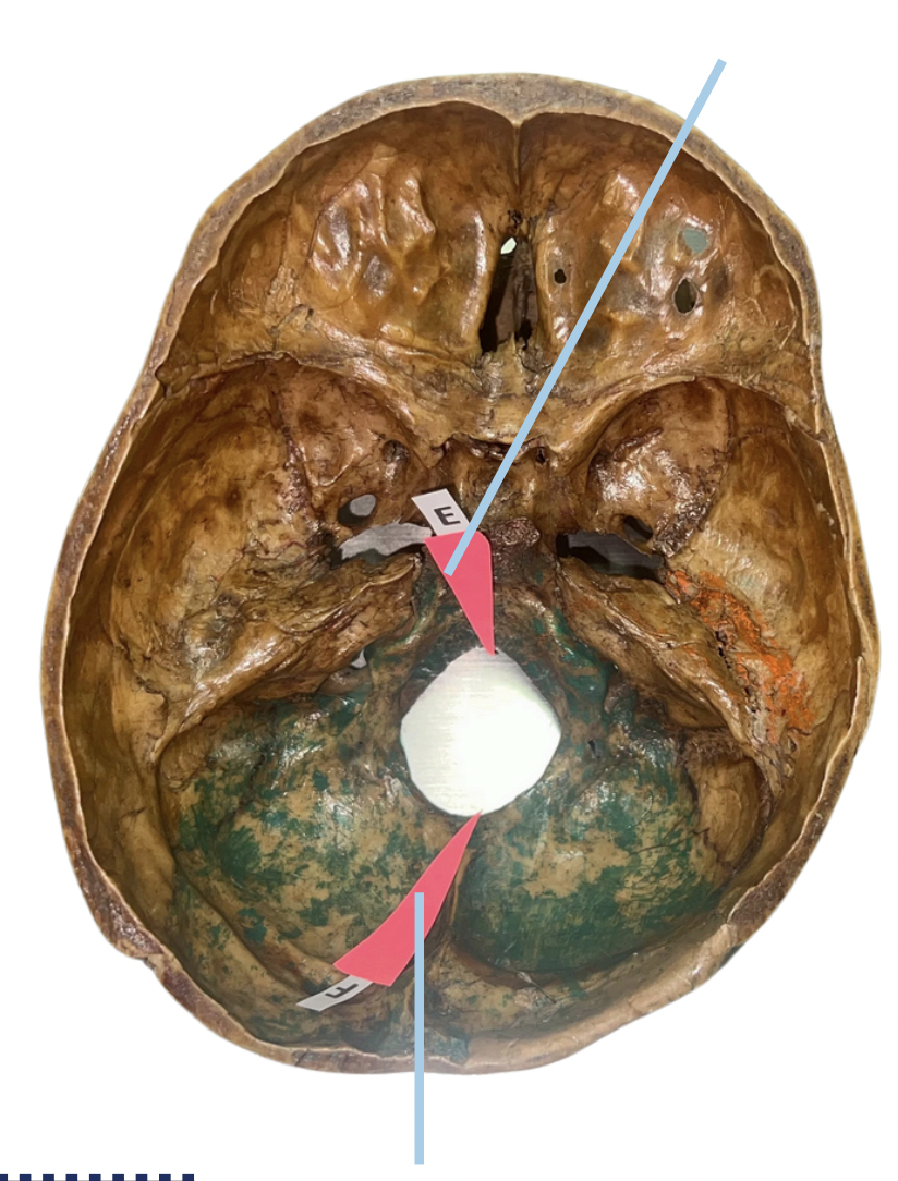 <p>Identify the suture labeled as E.</p>