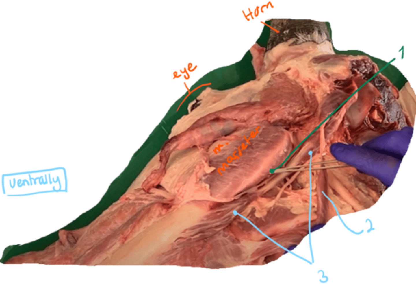 <p>identify the muscles in the picture. what type of muscles are they?</p>