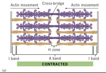 <p>Sarcomere with reduced length (filament lengths don’t change). I-bands and H-zone greatly reduced. Actin filaments are moved by myosin crossbridges</p>
