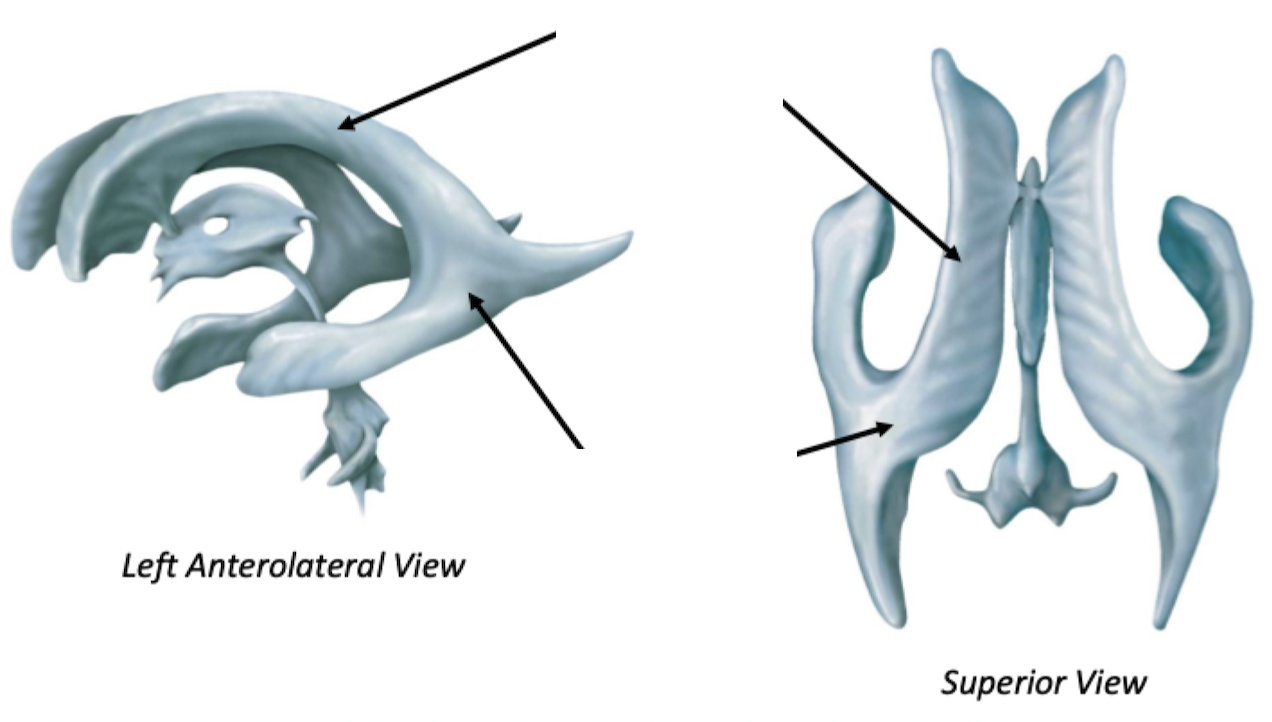 <p>Lateral Ventricles</p>