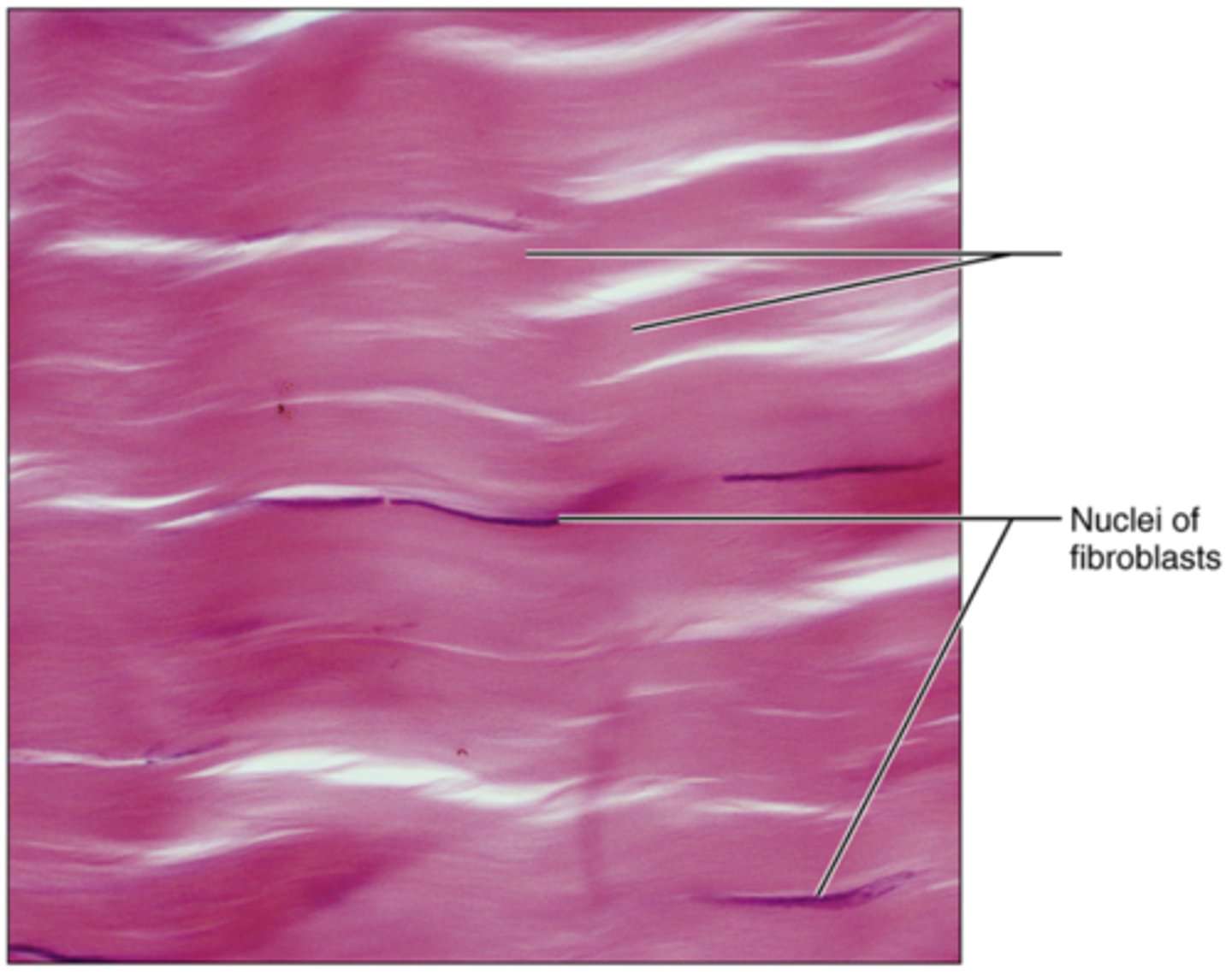 <p>Label the blank structure.</p>