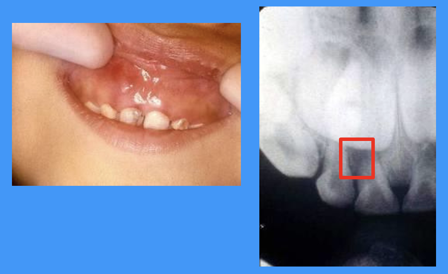 <p>what do these images show</p>