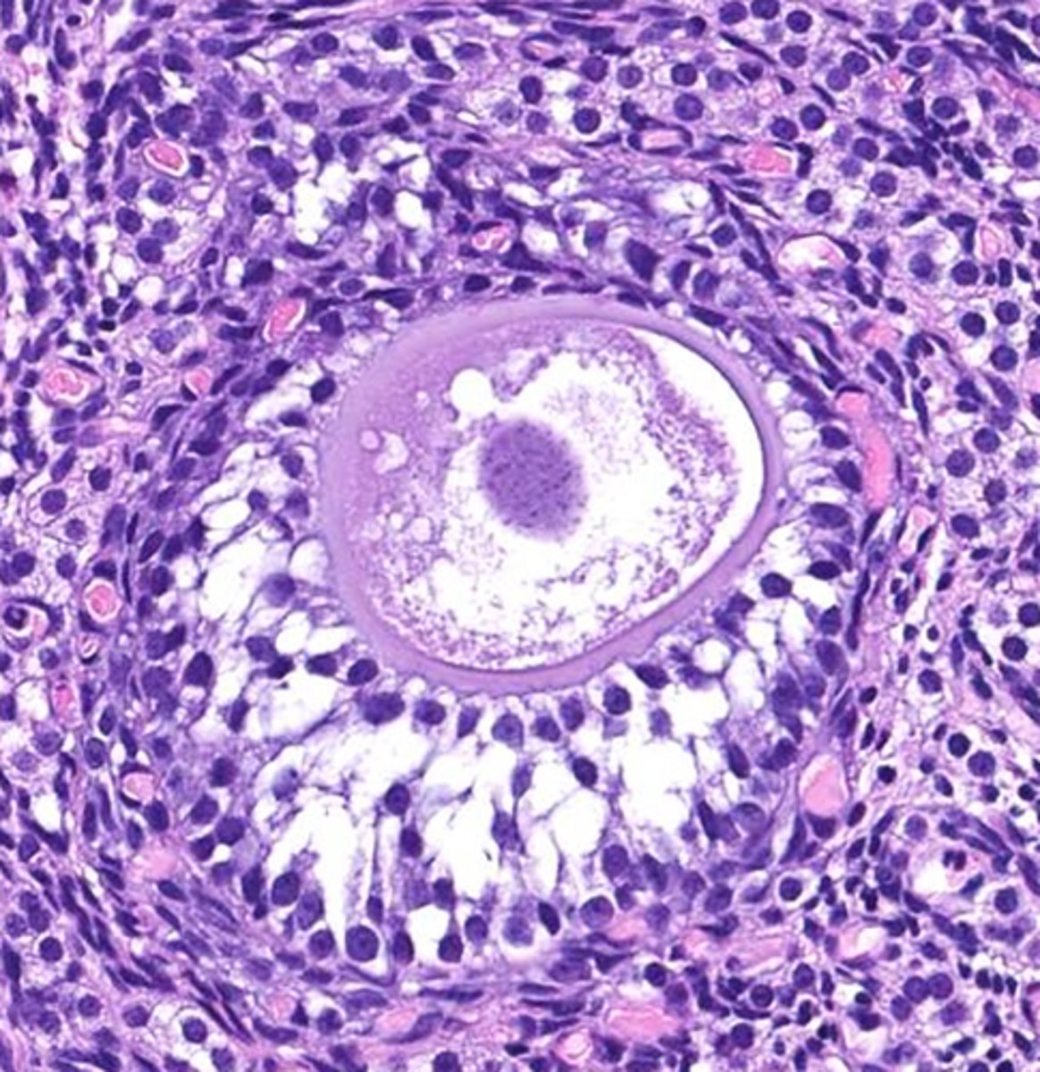 <p>_____ follicle</p>