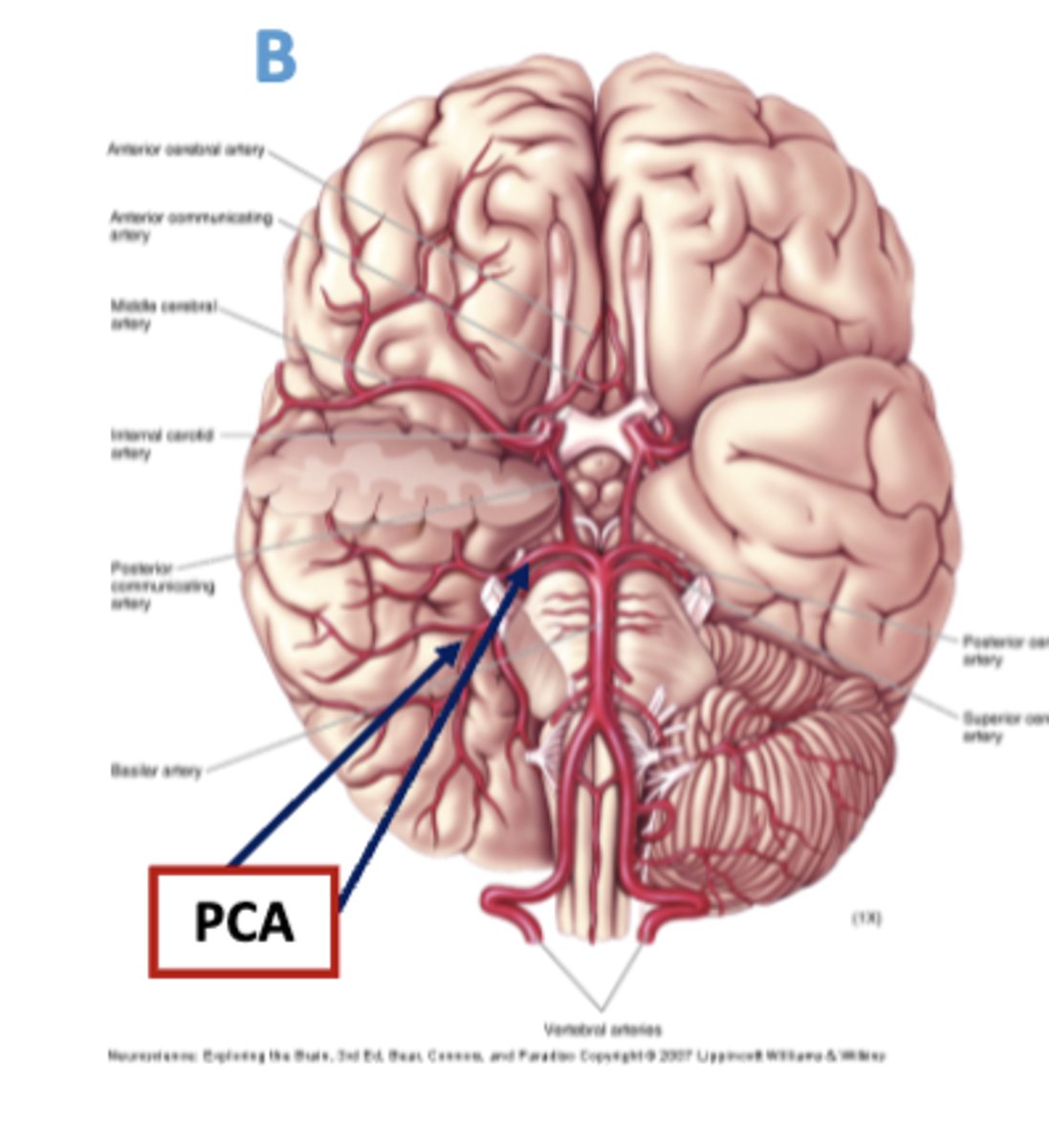 <p>on the inferior surface of the temporal lobe - it then spreads posteriorly and laterally </p>