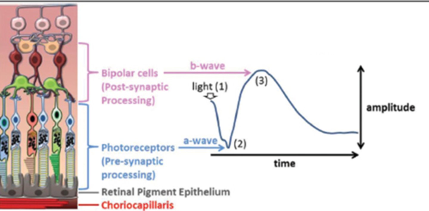 <p>What do the a and b wave show on <strong>ERG</strong>?</p>