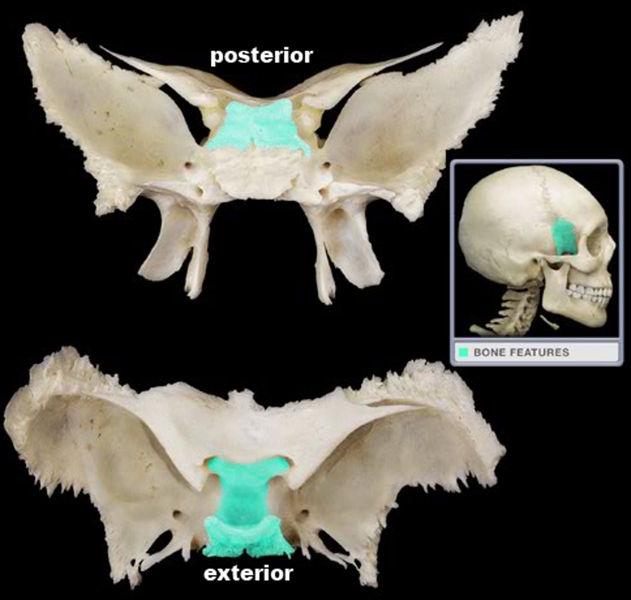 <p>Name this section and the bone it belongs to that holds that pituitary gland</p>