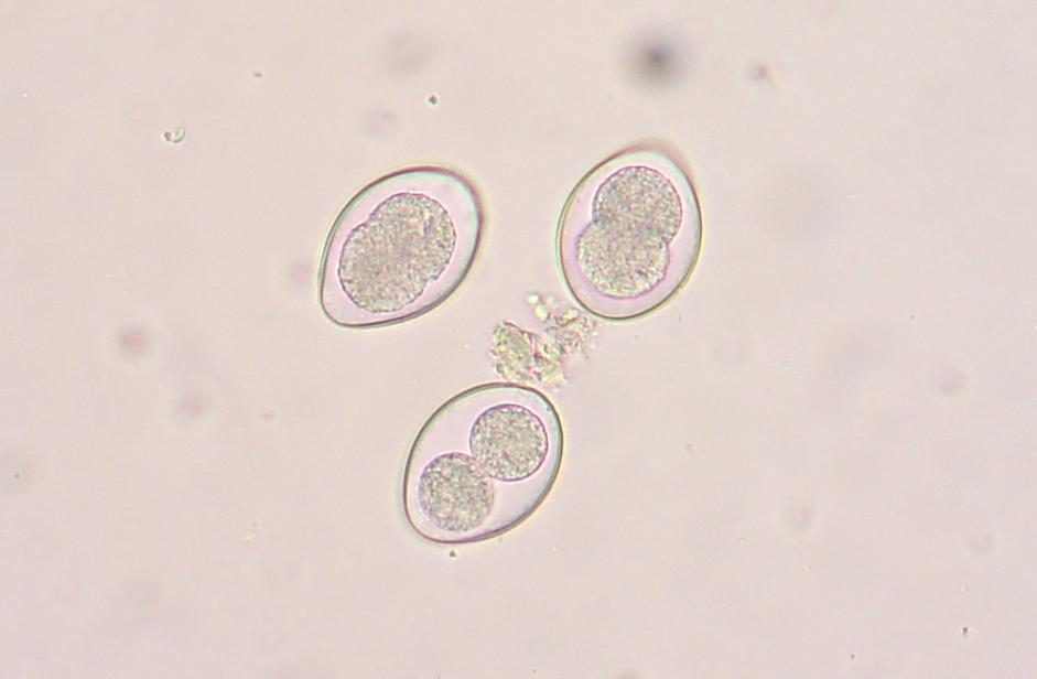 <p><strong>Phylum Apicomplexa:</strong></p><p><em>Class Coccidea</em></p>