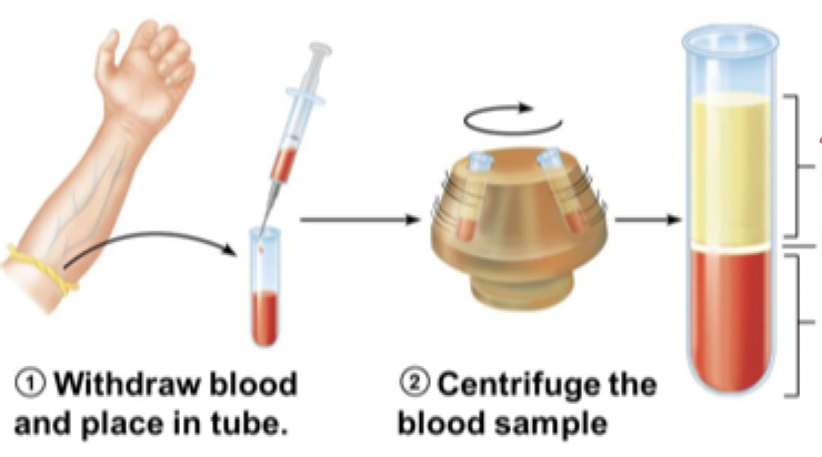 <p>hematocrit</p>