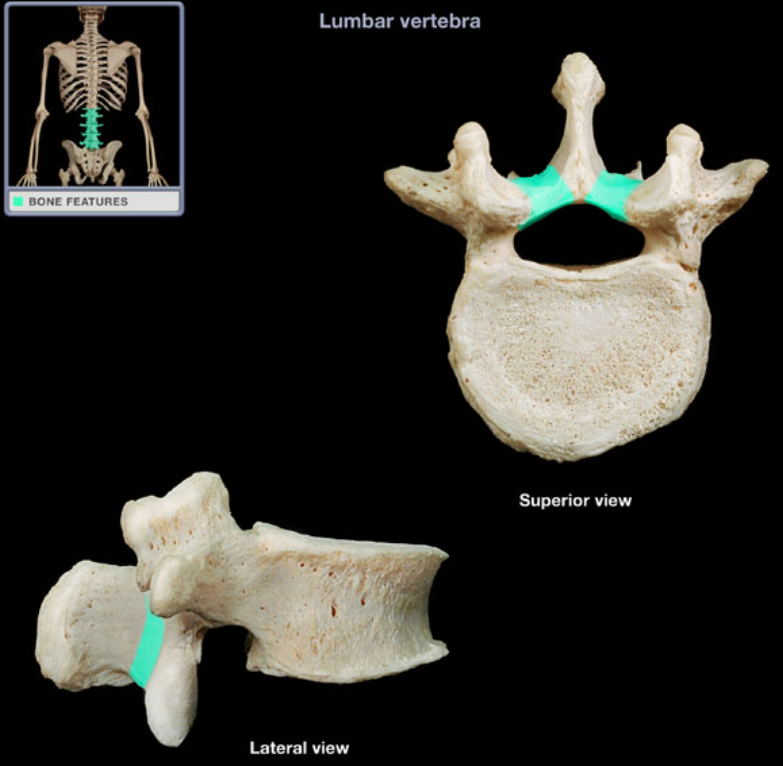 <ul><li><p>Location: L1-L5 vertebrae</p></li><li><p>Description: Paired plate that forms dorsal wall of vertebral canal, Connects pedicle to spinous process</p></li></ul><p></p>