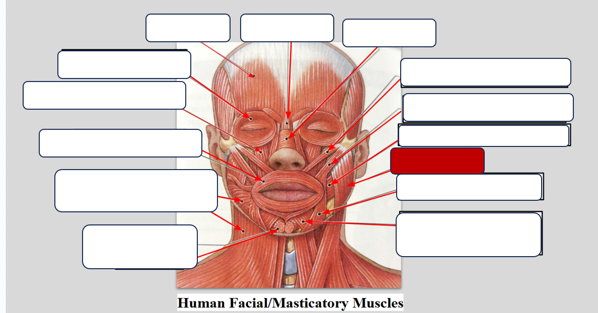 <p>Label the muscle.</p>