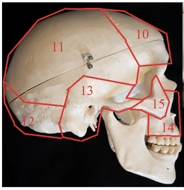 <p>15) name this bone </p>