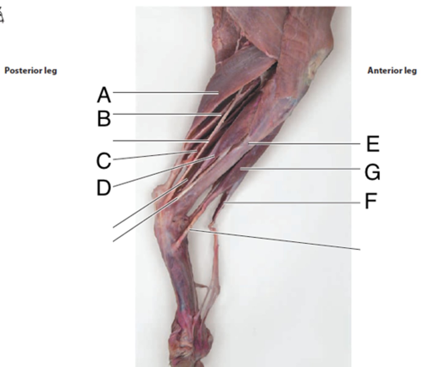<p>What is the muscle indicated by letter A? What is an attachment point and function?</p>