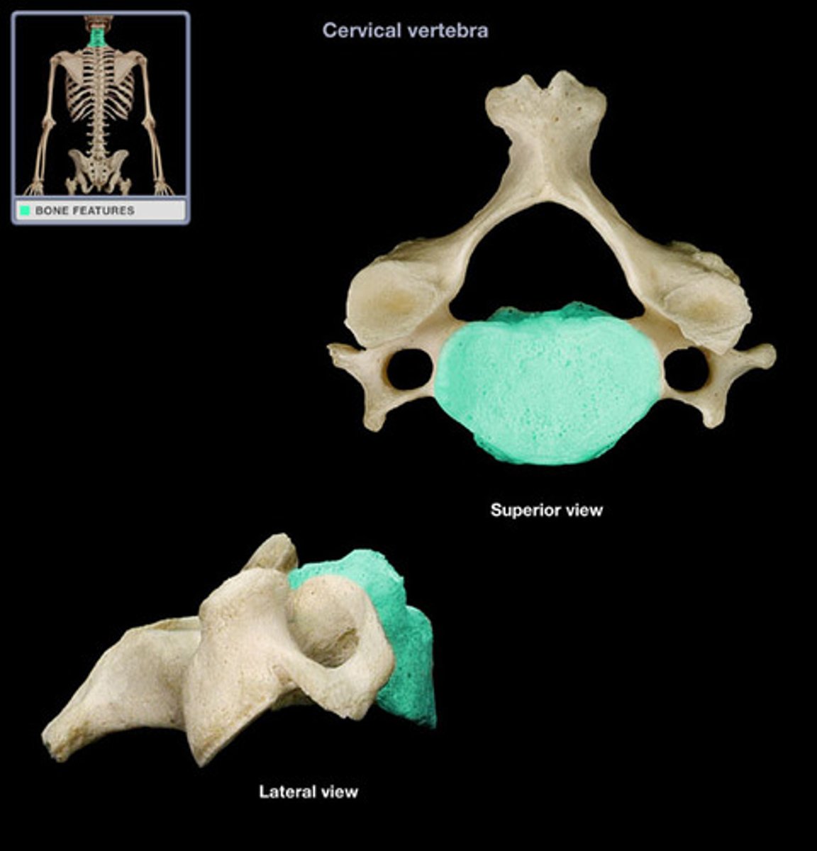 <p>the thick, disc-shaped anterior portion which is the weight bearing portion</p>