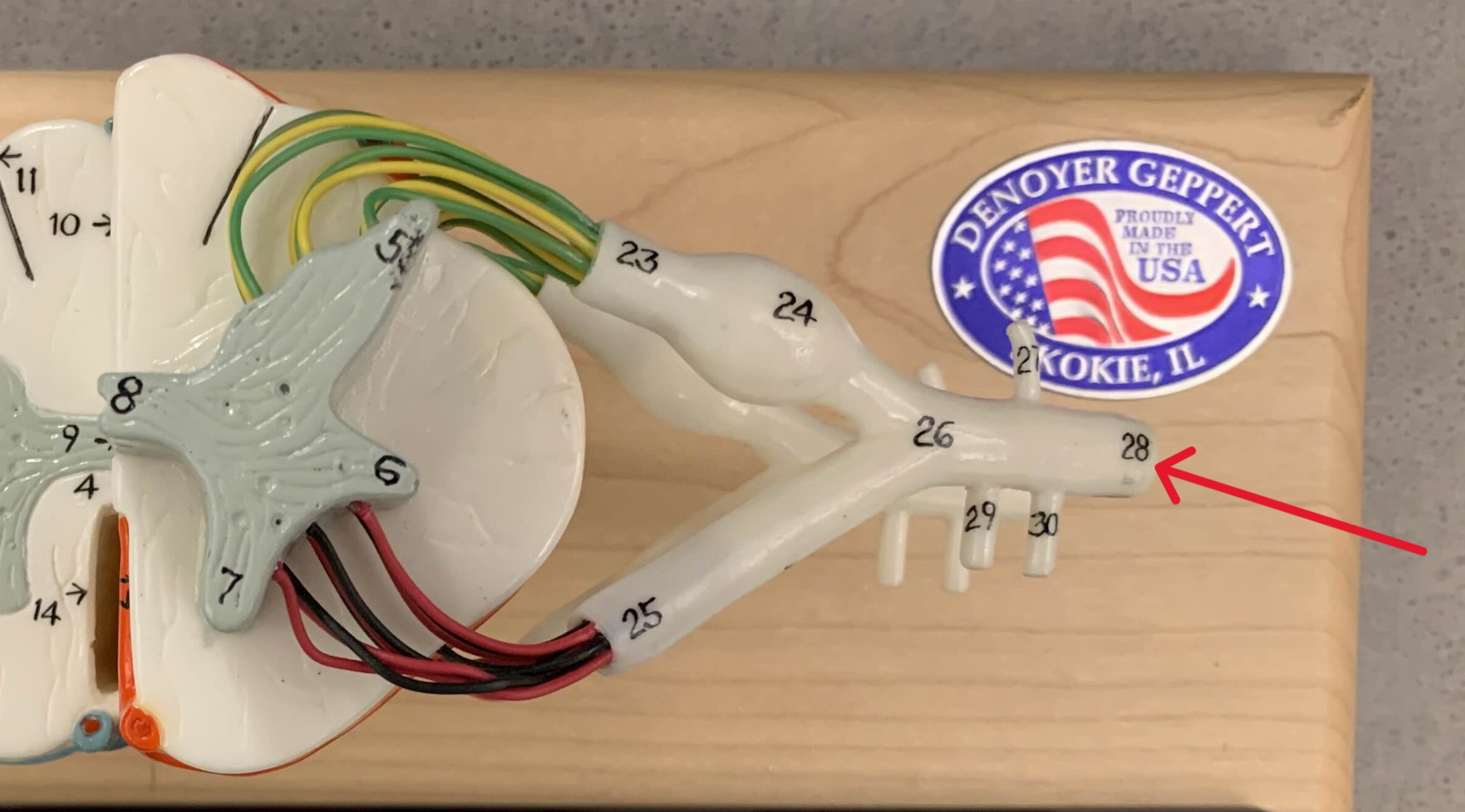 <p>Which ramus of the spinal cord is:</p><ul><li><p>Formed from ventral and dorsal roots joining</p></li></ul><p></p>