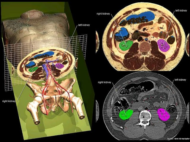 <p>This is what an MRI uses, here don’t see organs only planes!</p>