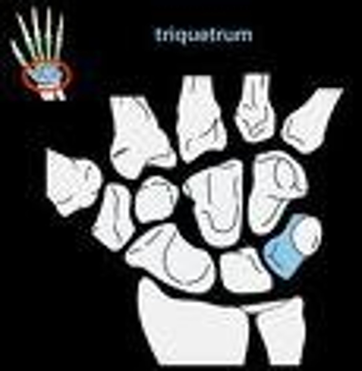 <p>- located in the wrist on the medial side of the proximal row of the carpus between the lunate and pisiform bones</p><p>- triangular bone</p>
