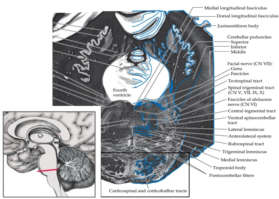 <p>in the ventral/anterior pons</p>
