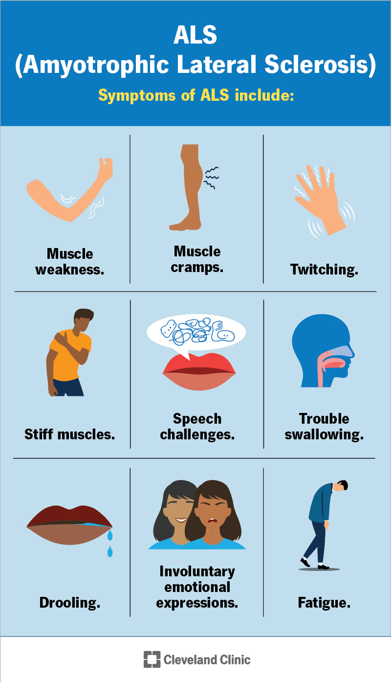 <ul><li><p><strong><mark data-color="blue" style="background-color: blue; color: inherit">motor neuron disease of unknown etiology</mark></strong></p></li><li><p>more prevalent in <strong>men </strong>than women</p></li><li><p>average onset at <strong>57</strong>, prognosis <strong>2-5yrs</strong></p></li><li><p><strong><mark data-color="purple" style="background-color: purple; color: inherit">sx:</mark></strong></p><ul><li><p><strong>muscle weakness &amp; atrophy</strong>. distally &amp; asymmetrically</p><ul><li><p>begins at <strong>hands</strong></p></li></ul></li><li><p><strong>cramps </strong>precede weakness</p></li><li><p>spasticity, hyperactive deep tendon reflexes, dysarthria, dysphagia</p></li><li><p>sensory systems, eyes, urinary</p></li></ul></li><li><p><strong>medication </strong>management (2 FDA approved options)</p></li><li><p>tx focused on <strong>secondary complication</strong>s (spasticity) </p></li></ul><p></p>