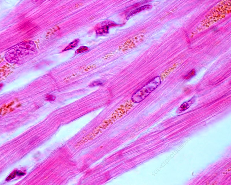 <p>Cardiac Muscle Tissue</p>