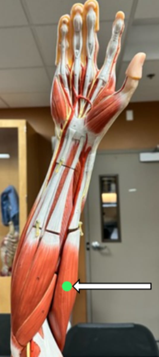 <p>brachioradialis (function)</p>