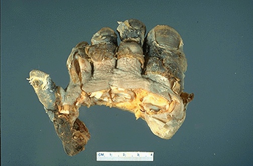 <p>a limb (usually lower leg)</p>