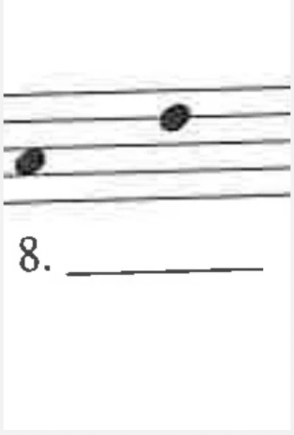 <p>What is the interval?</p>