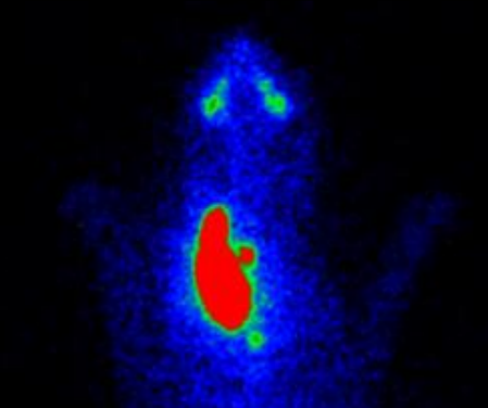 <p>describe the scintigraphy </p>