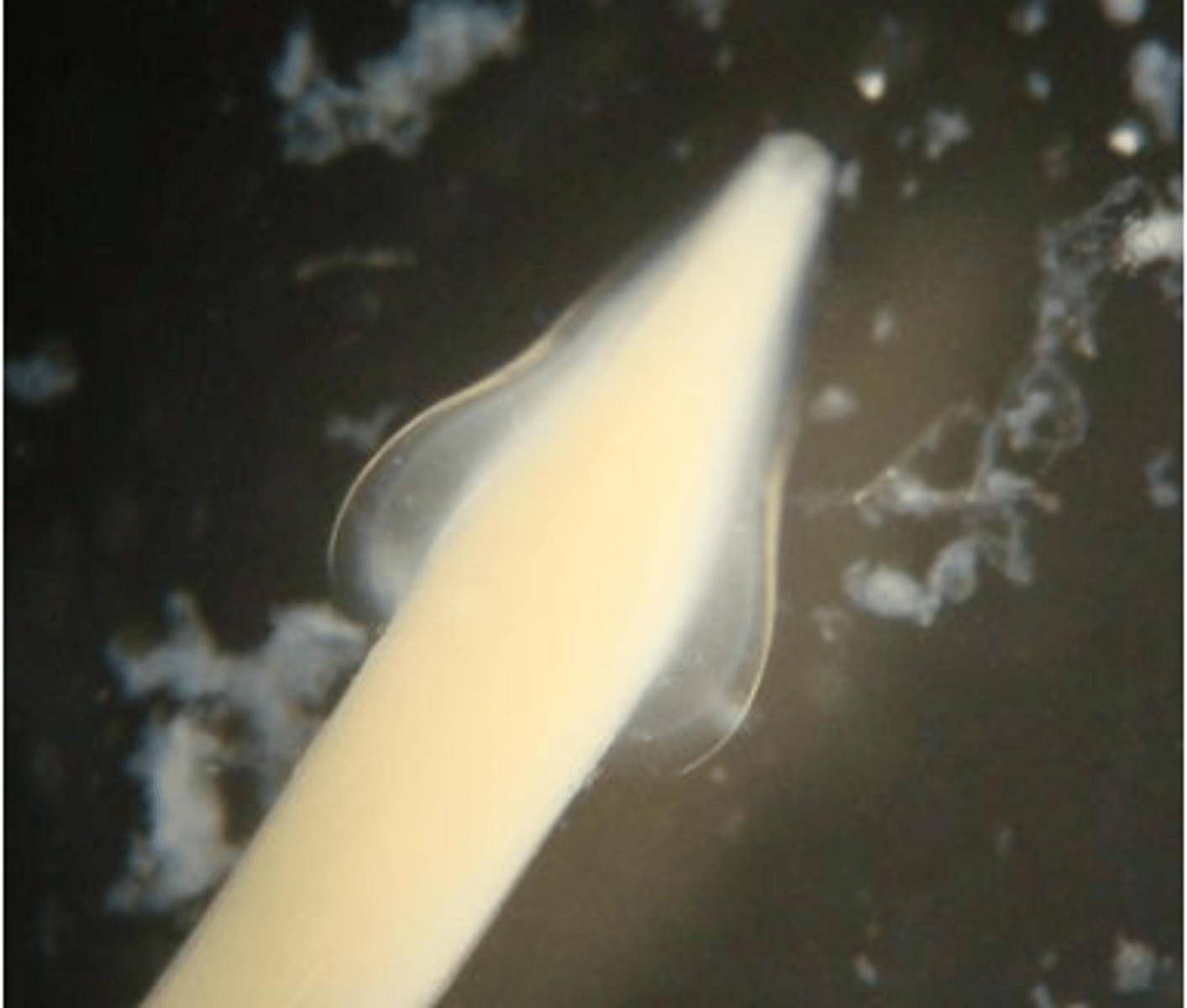 <p>Found in a kitten with poor weight gain without diarrhoea. What parasite is this?</p>