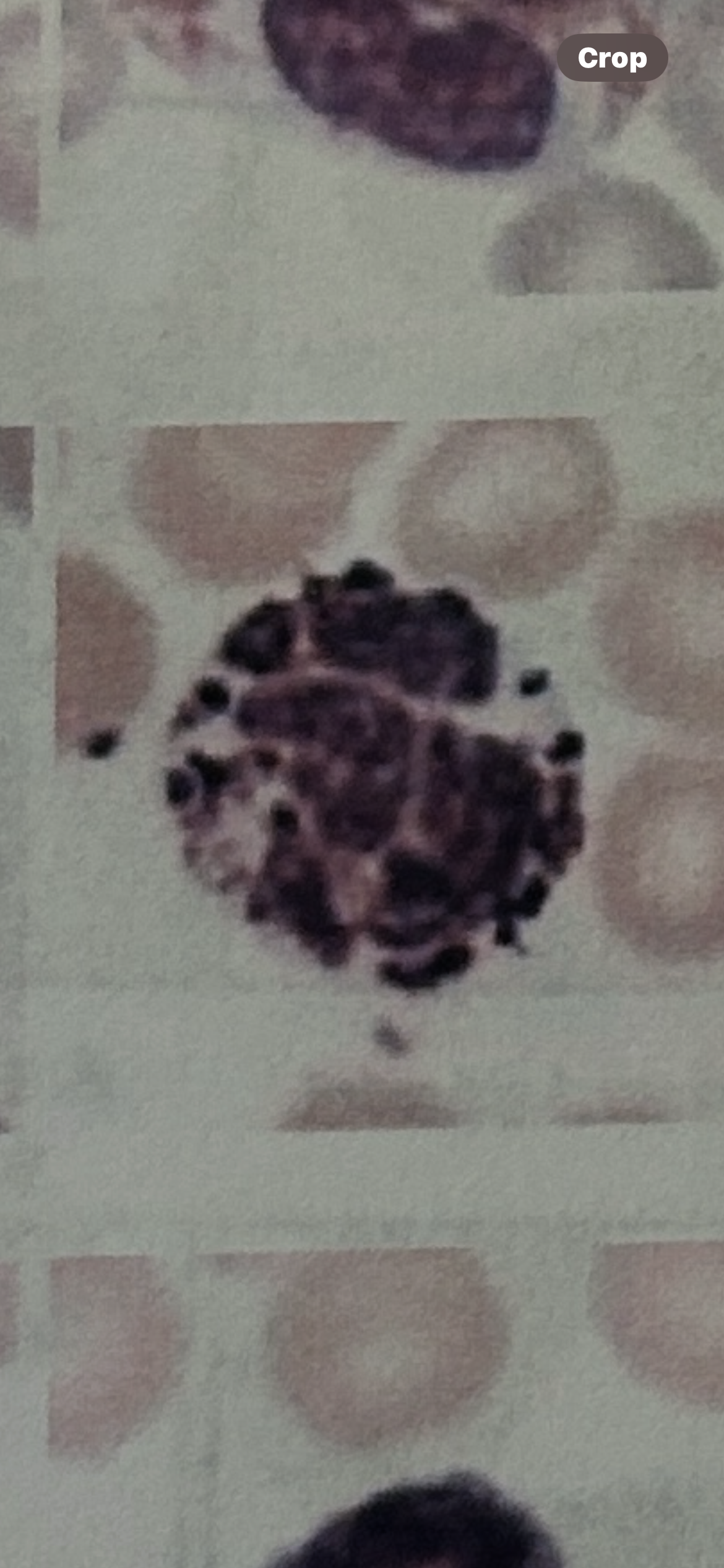 <p>WBC</p>