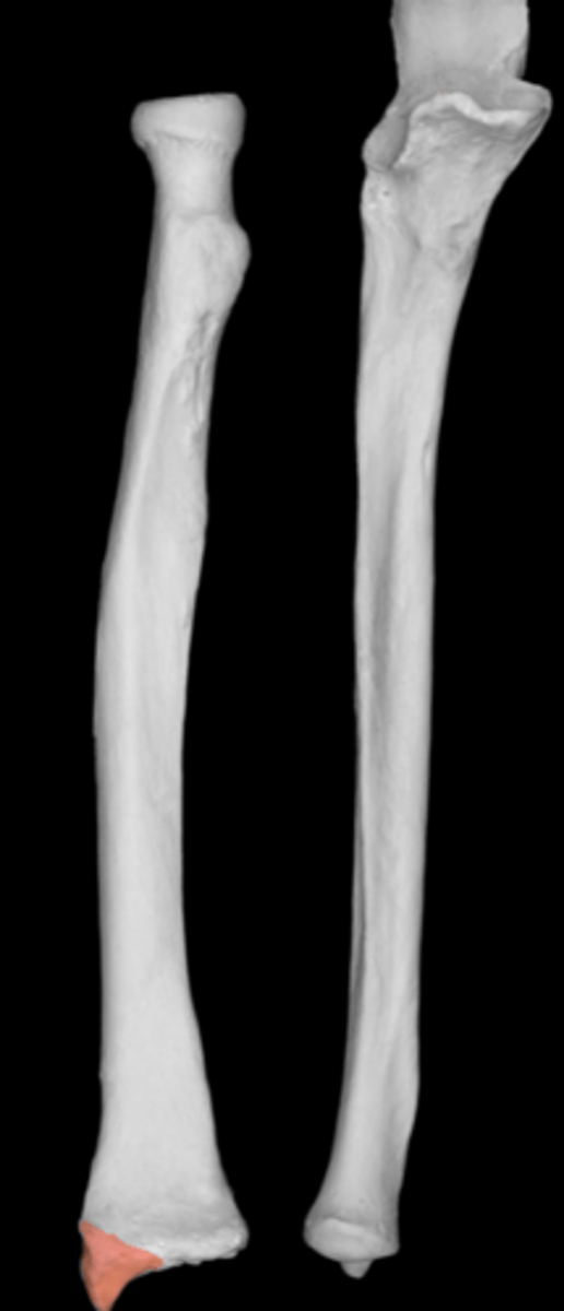 <p>articulates with carpal bones</p><p>wide and flat</p>