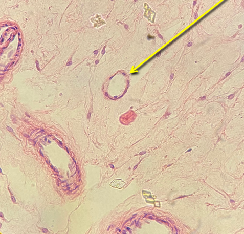 <p>quelle est la structure pointé dans l’image</p>