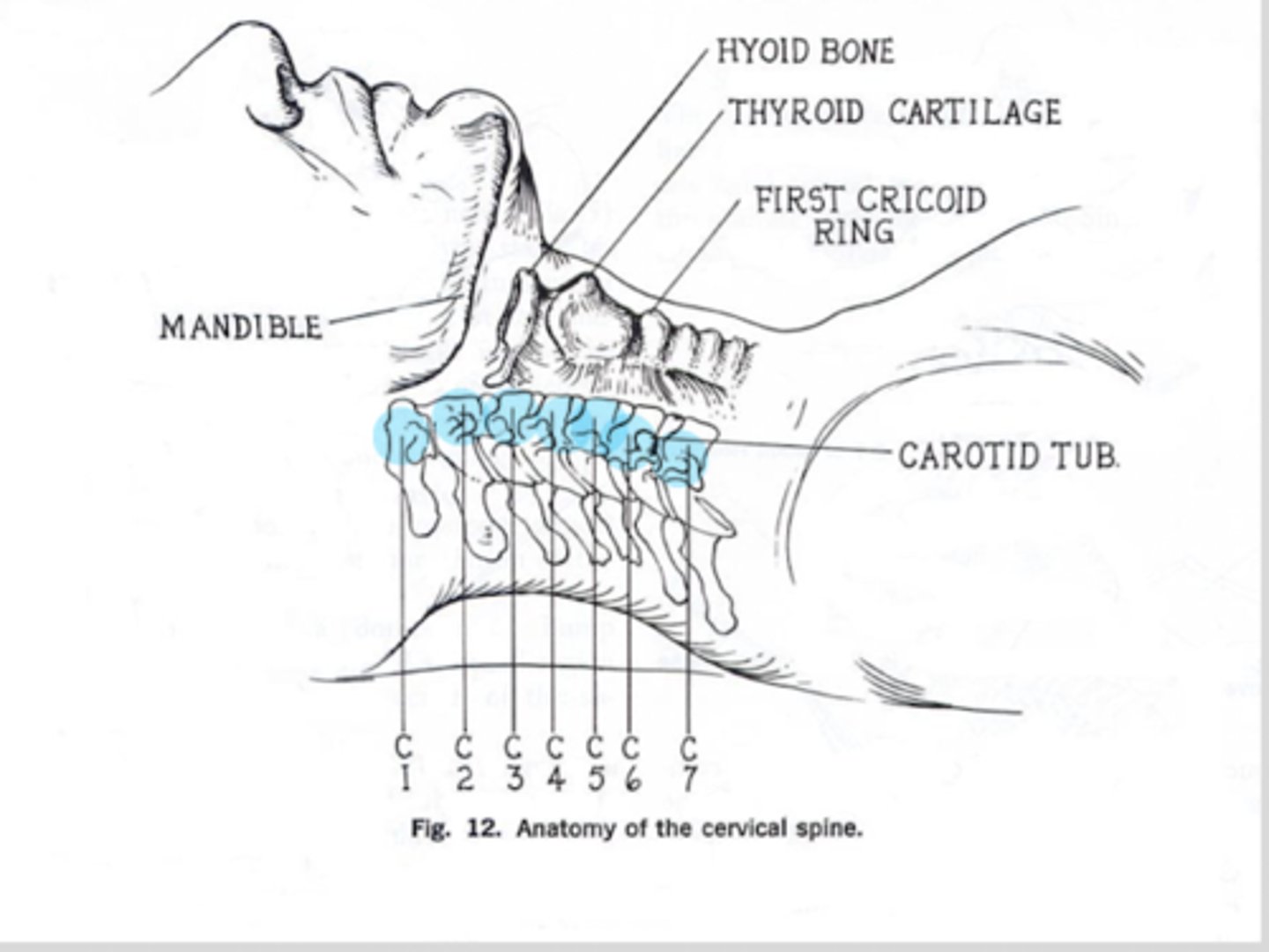 <p>C2-C7 follow type 2 mechanics</p><p>1. palpate spinous process of segment being evaluated</p><p>2. move fingers laterally about 1/2 an inch and anteriorly to palpate articular pillars</p><p>3. feel which side appears more posterior to the table</p><p>OR push articular pillar gently from left to right and right to left - identify loss of translation</p><p>4. check segments in F/E</p><p>first branch of left and right subclavian artery enters @ C5-C6 level into the transverse foramen of vertebra</p><p>LANDMARKS:</p><p>C1: TP located behind ascending ramus of jaw</p><p>C2: level of the angle of the mandible</p><p>C3: level of hyoid bone</p><p>C4: @ superior aspect of thyroid cartilage</p><p>C5: @ thyroid cartilage body</p><p>C6: @ first cricoid ring or carotid tubercle</p><p>C7: vertebral prominens</p>