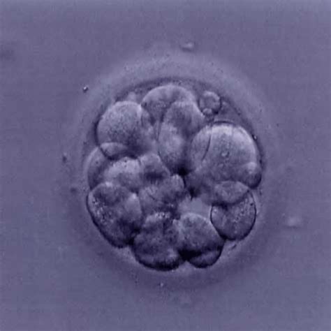 <p>Solid ball of cells (16-64 cells; no bigger than zygote)</p><p>Result of repeated cell division of the zygote</p>