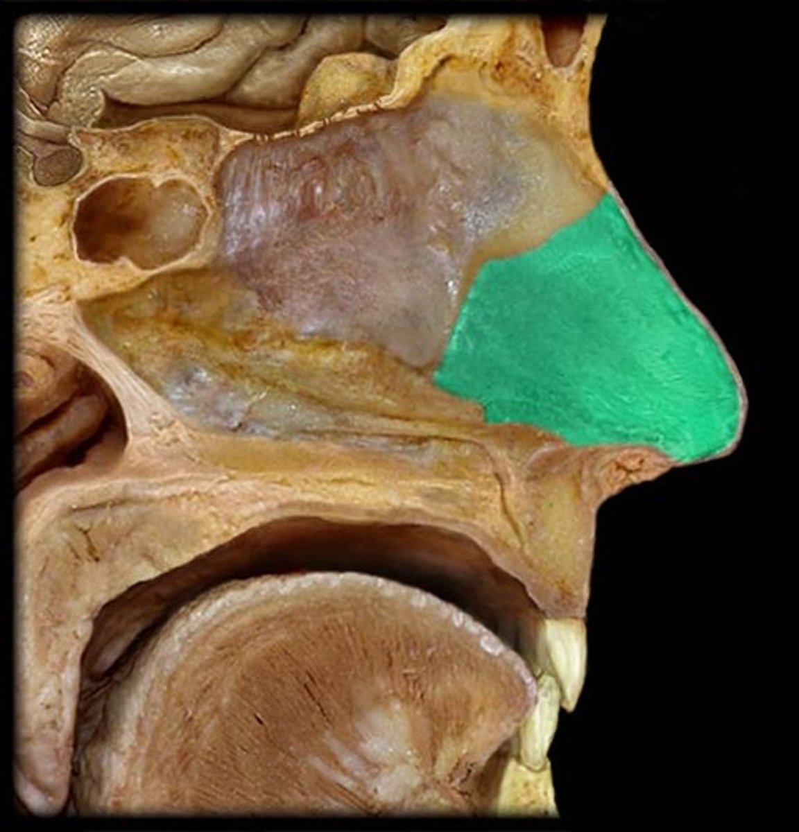 <p>cartilage that separates nostrils</p>