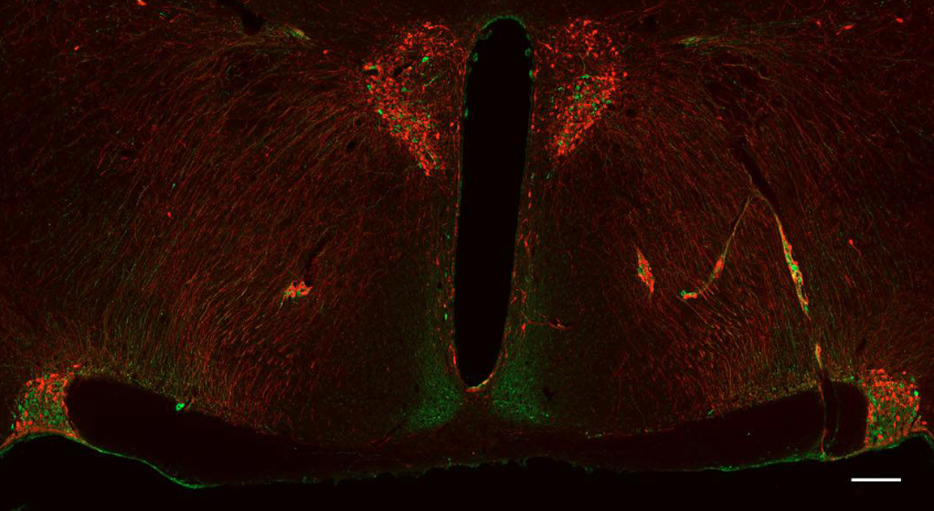 <p>Where are the <span>magnocellular and parvocellular neurons in this image?</span></p>