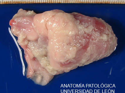 <p>Pericarditis fibrinosa y fibrosa. Ave.</p>