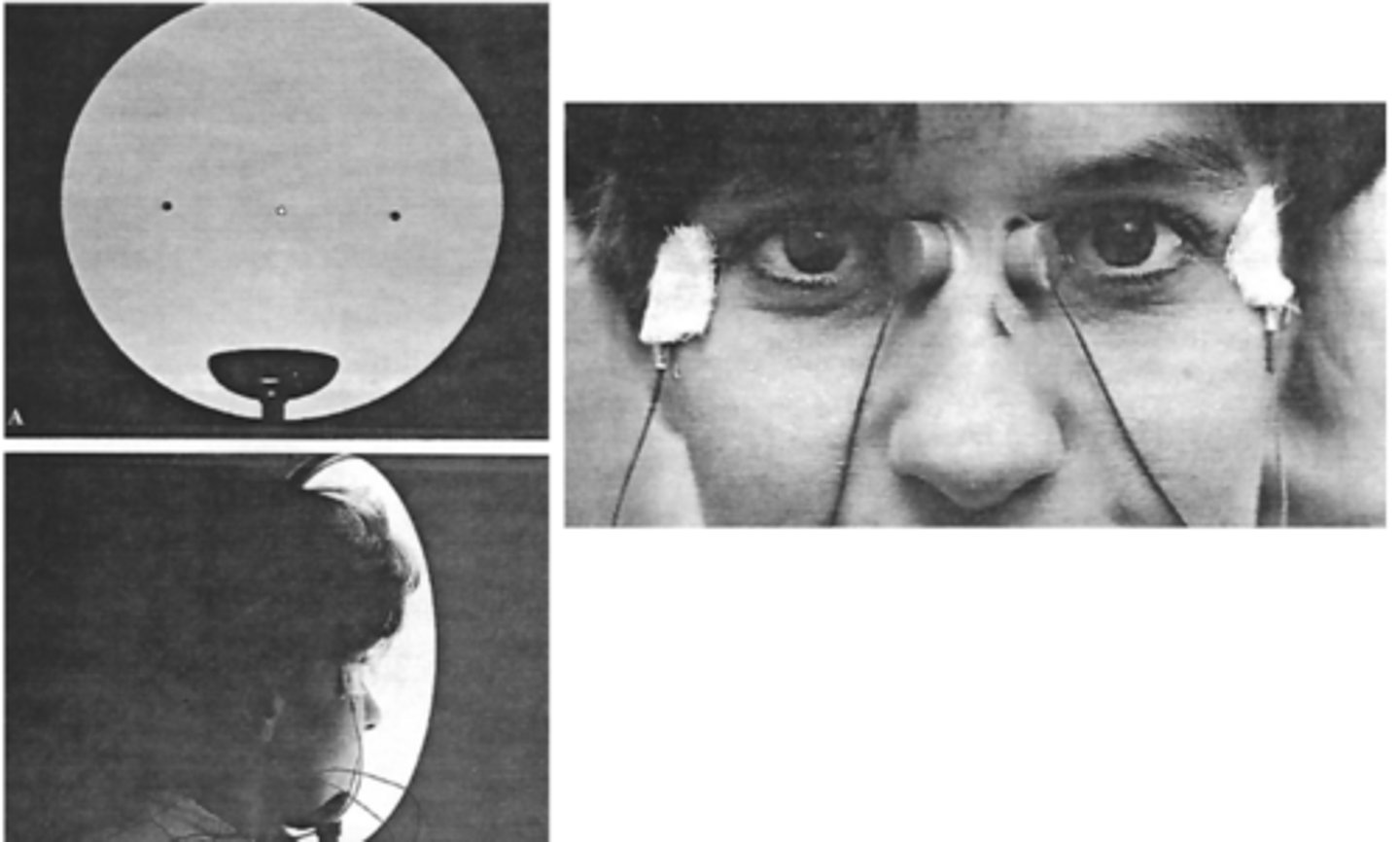 <p>electrophysiological test which measures the large dipole formed by the RPE and cornea. The anterior pole of the eye (cornea) is positively charged, whereas the posterior pole (Bruch's membrane) is negatively charged. At rest the net charge across the canthi is therefore zero, and any eye movement away from primary gaze can elicit a charge change which can be measured via electrodes placed at the canthi.</p>