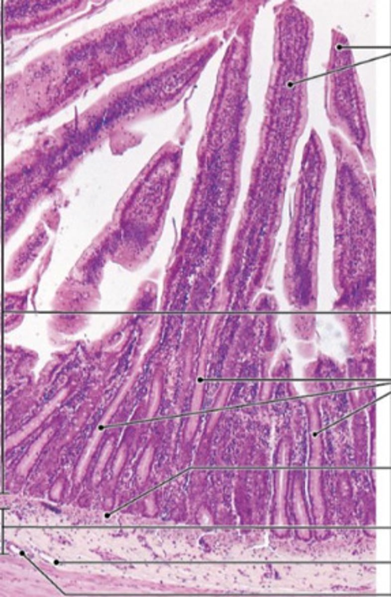 <p>ID the Histology</p>