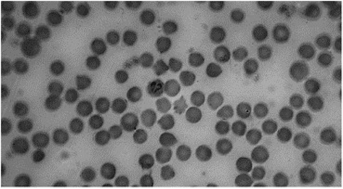 <p>This large piroplasm is found in the red blood cells of cattle and spread by the tick</p><p>Rhipicephalus annulatus. This protozoan is:</p>