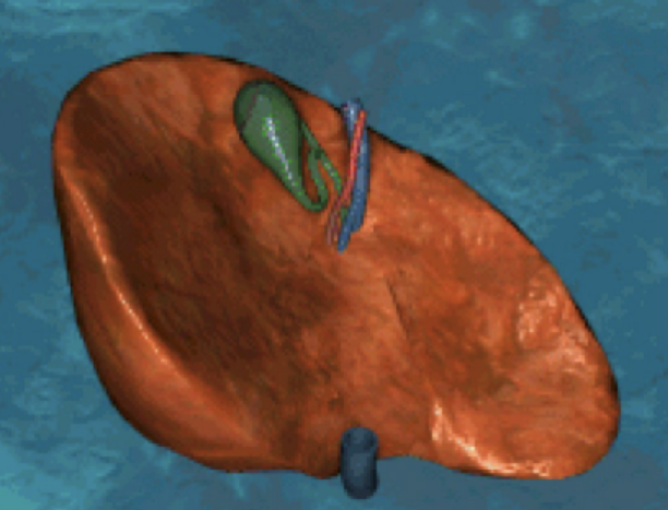 <p>Which surface of the liver is this? And describe it. </p>
