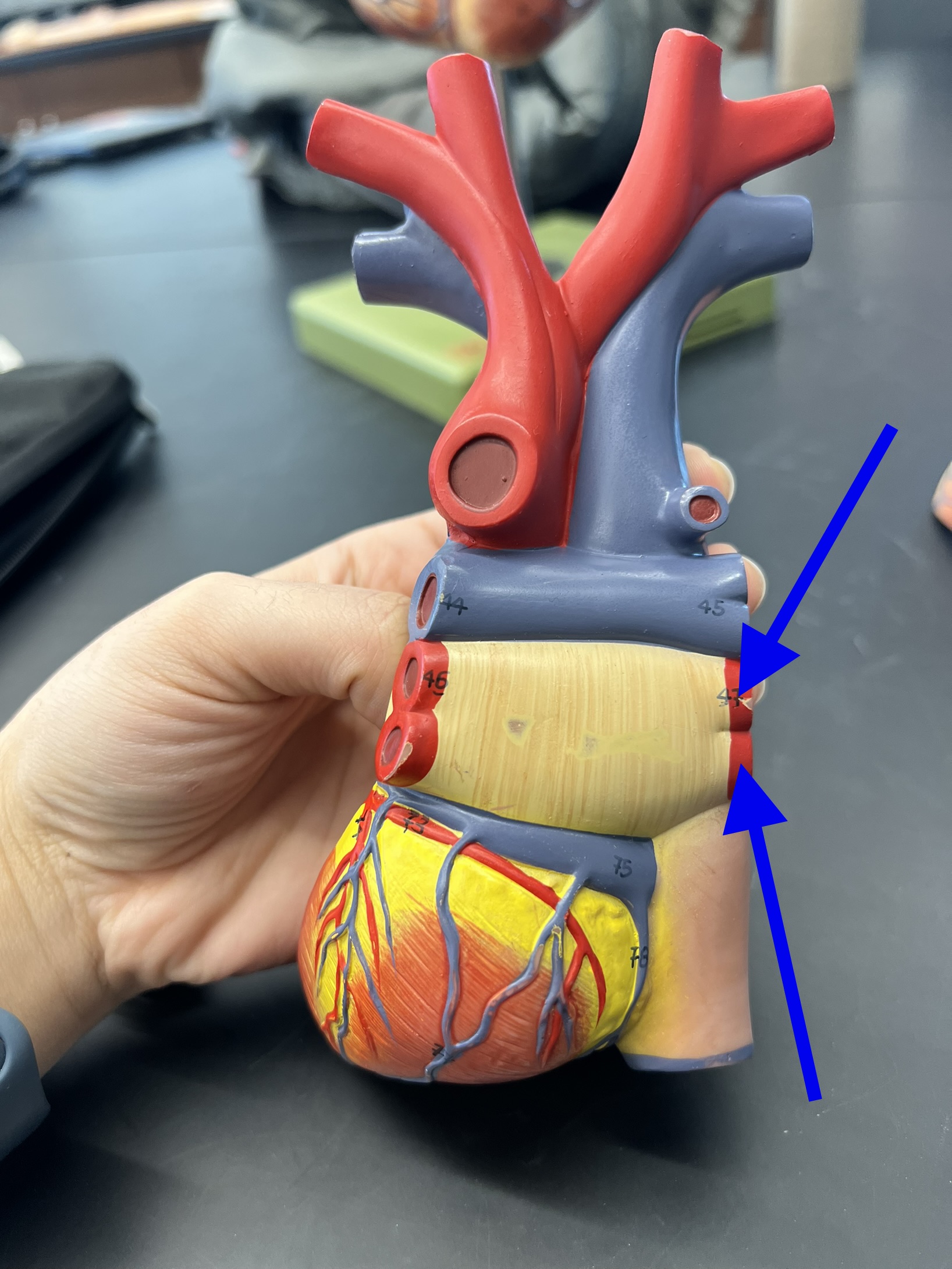 Name the heart structure.