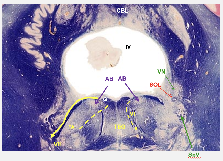 <p>caudal pons cross section stuctures</p>