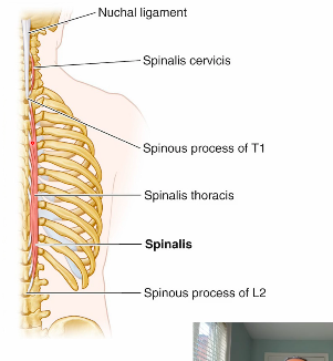 <p>spinalis insertion</p>