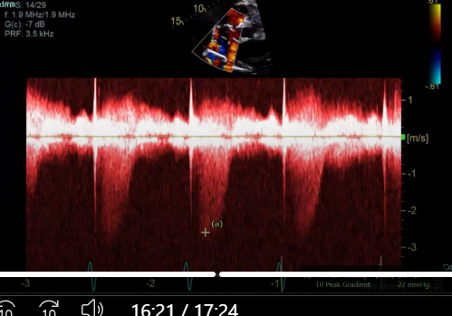 <p>what measurement is this for</p>