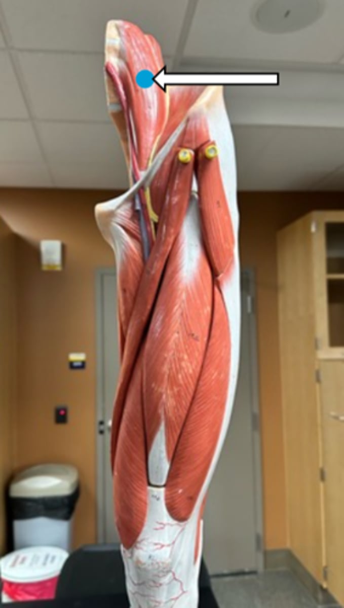 <p>psoas major (function)</p>