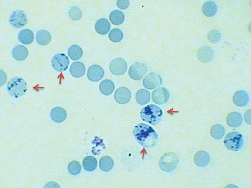 <p>What cells are the arrows pointing to?</p>